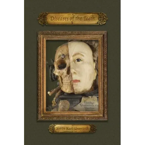 Diseases of the Teeth